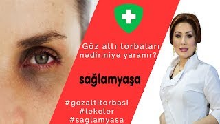 Göz altı torbaları(qaralmalar) niyə yaranır? | Sağlam Yaşa