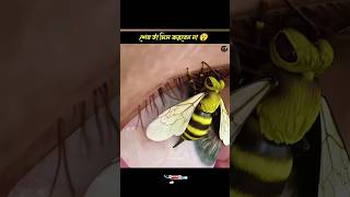 Alert 🚨 মৌমাছি চোখে হুল ফোটালে 🐝🍯|| If  bee sting You || #shortsfeed #short #facts #amazingfacts