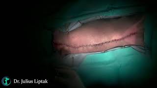 Bilateral Mastectomy in a Cat with Mammary Carcinoma, 2025/01/09