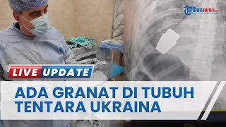 Nasib Tentara Ukraina yang Hidup dengan Granat VOG Aktif, Drama Dokter Militer Lakukan Operasi Bedah