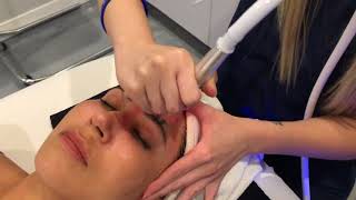 Best Facial Ever - Bio Infusion Facial Los Angeles