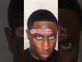 how to restore your thin hairline💯🔥🔥🔥 360silk hairloss hairgrowth