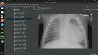 CNN,KNN,SVM, Python code