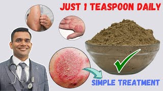 Just 1 Teaspoon Daily To Cure all Your Skin Problems | Eczema - Simple Treatment