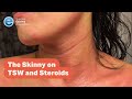 Webinar: The Skinny on TSW and Steroids