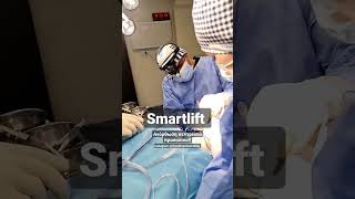 Χαλάρωση στο πρόσωπο - Smartlift #plasticsurgery #plasticsurgeons