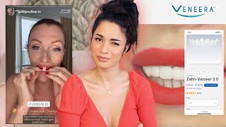 Veneers to go (Wie gut ist es? Zahnfee reagiert)