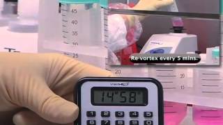 AFB Specimen Processing
