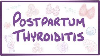 Postpartum thyroiditis - causes, symptoms, diagnosis, treatment, pathology
