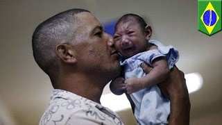 Microcephaly: condition linked to Zika virus causes babies to be born with shrunken heads - TomoNews