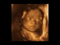 28 Weeks Baby 3D 4D Ultrasound - My Sunshine Baby Charlotte 28 Weeks Baby 3D 4D Ultrasound - My Sunshine Baby Charlotte
