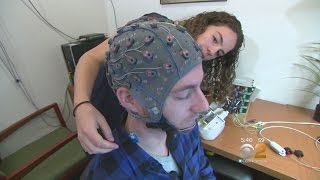 Dr. Max Gomez: Brain Scans