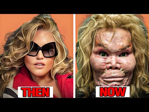 13 Horrifying Celebrity Alterations: The good, the bad, & downright ugly!