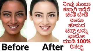 ಮುಖ ಎಷ್ಟೇ ಕಪ್ಪಾಗಿ ಇದ್ದರು ಇದನ್ನ ಹಚ್ಚಿ Home remedy for whitening and glowing skin| 100% results|