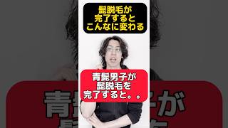 青髭男子が髭脱毛を完了すると実際どの様な変化があるの？経験者がリアルを共有致します！