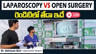 Difference Between Open Surgery And Laparoscopic Surgery in Live Demo Session || Dr Abhilash Nali