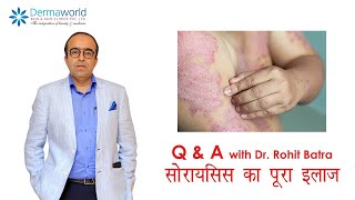 Q&A with Dr Rohit Batra | सोरायसिस का पूरा इलाज | In Hindi | Episode 3