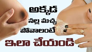 అక్కడ నల్ల మచ్చ పోవాలంటే ఇలా చేయండి || Dark Elbows || Myna Style Corner