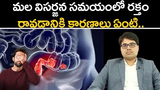 Rectal Bleeding Causes | మల విసర్జన సమయంలో రక్తం రావడానికి కారణాలు ఏంటి.. | Samayam Telugu