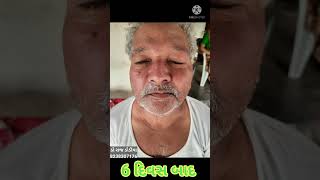 ચહેરા નો લકવો 15 દિવસ મા સરખો થયો, bells palsy