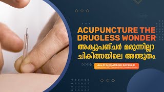 Acupuncture the Drugless Wonder || അക്യുപങ്ചര്‍ മരുന്നില്ലാ ചികിത്സയിലെ അത്ഭുതം