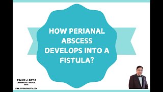 HOW PERIANAL ABSCESS DEVELOPS INTO A FISTULA?