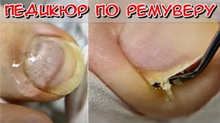 Remover pedicure / How to cut nails / men's pedicure