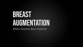 Breast Augmentation, Gummy Bear Implants - Before & After Pictures
