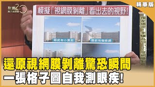 「我以為我會瞎掉!」9成視野瞬間消失！李驥還原視網膜剝離驚恐瞬間!【聚焦2.0】第563集