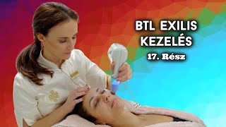 EverDerm Reality 2. évad - BTL Exilis Arckezelés - 17. rész