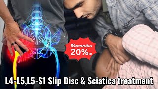 L4-L5-S1 Slip Disc \u0026 Sciatica Treatment For CHIROPRACTIC  #chiropractormoradabad #chiropractorindia