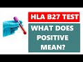 WHAT DOES HLA-B27 TEST POSITIVE MEAN?