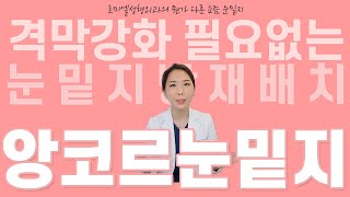 격막강화 필요없는 눈밑지방재배치가 있다? 정답은 앙코르눈밑지 입니다!