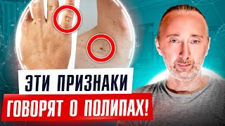 ПОЛИПЫ: Сделайте ЭТО и ОНИ уйдут без операций! ВОТ признаки опухолей в желудке, кишечнике, матке...