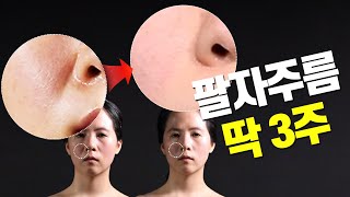 [Full ver] 팔자주름 펴는 충격적인 그 물질?! ✔지금 조명 아래에서 확인!