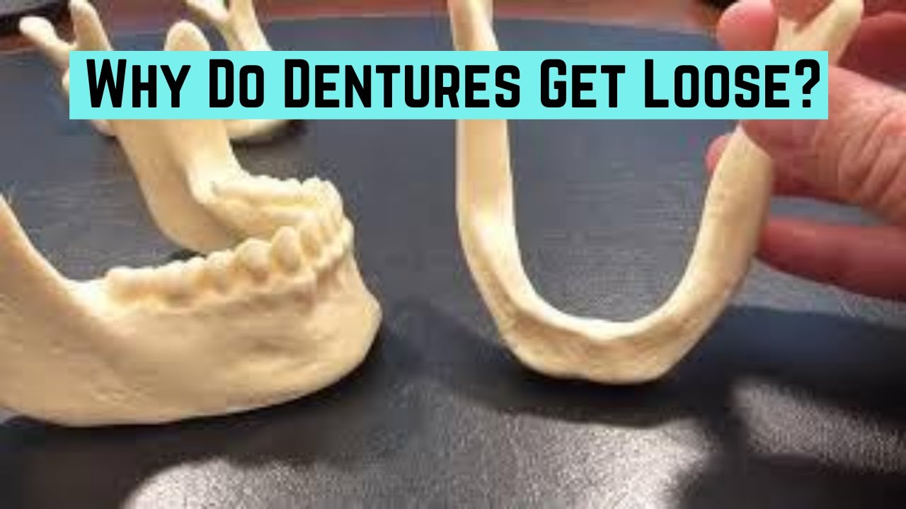 Why Do Dentures Get Looser Over Time Youtube