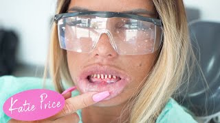 KATIE PRICE: TEETH RECONSTRUCTION (HORRIFIC!)