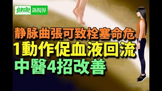 靜脈曲張可致拴塞｜靜脈曲張影響女性美觀｜一個動作促進血液循環｜中醫四招改善｜西醫血管內雷射治療| #健康新視界