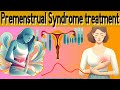 PMS (Premenstrual syndrome) Signs and treatment explained  in 5 minutes