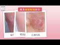 DERMA LAB 德美醫研_極效安敏舒護精華