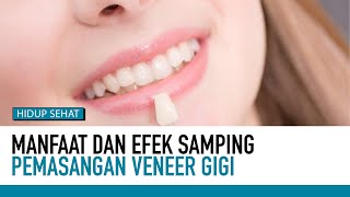 Cara Pemasangan dan Resiko Penggunaan Veneer Gigi | Hidup Sehat tvOne