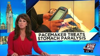 VIDEO: Pacemaker treats stomach paralysis
