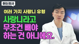 사랑니, 무조건 빼야한다?! 사랑니 어금니로 대체 가능한 케이스와 발치 케이스 전격비교