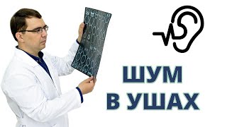 ШУМ В УШАХ: почему шумит и что с этим делать?