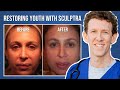 How to Restore the Youth with Sculptra?