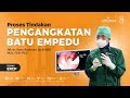 Pengangkatan Batu Empedu tanpa operasi menggunakan metode ERCP