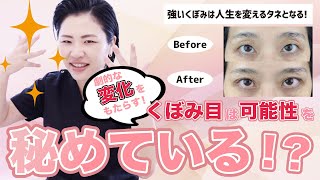 【くぼみ目が】秘めた可能性とは？劇的な変化をもたらす目！？【二重テープ卒業】