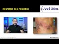 neuralgia pós herpética josé góes