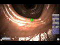 EndoSim Fundamental Endoscopy Skills 1: Visualize the Colon