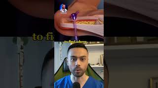 Podiatrist Explains Plantar Fasciitis Surgery😀 #medical #health #viral